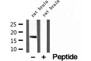 Western blot analysis of extracts of rat brain tissue, using CPLX1 antibody. (Complexin 1 antibody  (N-Term))