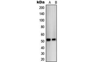 Western blot analysis of THRB expression in SKBR3 (A), C32 (B) whole cell lysates. (THRB antibody  (N-Term))