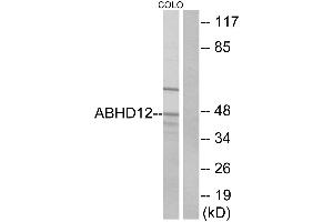 Western blot analysis of extracts from COLO cells, using ABHD12 antibody.