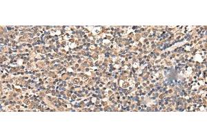Immunohistochemistry of paraffin-embedded Human tonsil tissue using ZSCAN12 Polyclonal Antibody at dilution of 1:50(x200) (ZSCAN12 antibody)