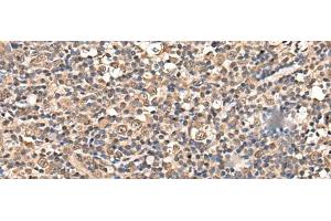 Immunohistochemistry of paraffin-embedded Human tonsil tissue using ZSCAN12 Polyclonal Antibody at dilution of 1:50(x200) (ZSCAN12 antibody)