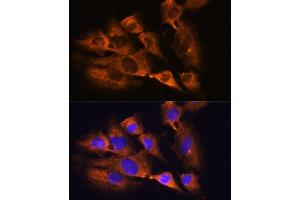 Immunofluorescence analysis of C6 cells using ACHE Rabbit pAb (ABIN3016742, ABIN3016743, ABIN3016744 and ABIN6219831) at dilution of 1:100. (Acetylcholinesterase antibody  (AA 398-617))