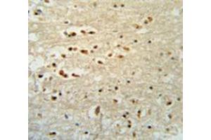 Immunohistochemistry analysis in human brain tissue (Formalin-fixed, Paraffin-embedded) using PTOV1  Antibody  (N-term), followed by peroxidase conjugated secondary antibody and DAB staining. (PTOV1 antibody  (N-Term))