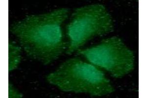 ICC/IF analysis of CIB1 in HeLa cells line, stained with DAPI (Blue) for nucleus staining and monoclonal anti-human CIB1 antibody (1:100) with goat anti-mouse IgG-Alexa fluor 488 conjugate (Green). (CIB1 antibody)