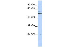 PRMT2 antibody used at 1 ug/ml to detect target protein.
