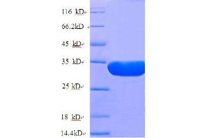 NUP210 Protein (AA 1529-1808, partial) (His tag)