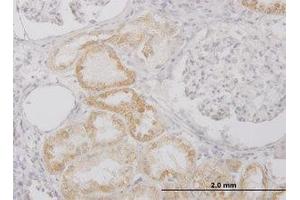 Image no. 2 for anti-Peptidase Inhibitor 15 (PI15) (AA 18-118) antibody (ABIN599240) (PI15 antibody  (AA 18-118))