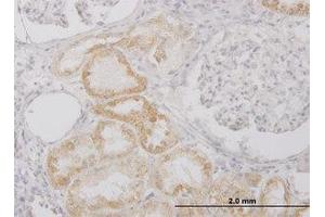 Image no. 2 for anti-Peptidase Inhibitor 15 (PI15) (AA 18-118) antibody (ABIN599240)