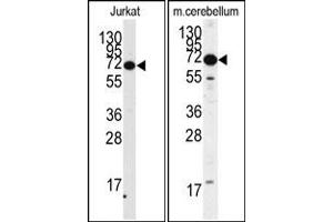 Image no. 1 for anti-Methyl CpG Binding Protein 2 (MECP2) antibody (ABIN357797) (MECP2 antibody)