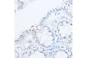Immunohistochemistry of paraffin-embedded human colon using UBI Rabbit pAb (ABIN6134945, ABIN6149844, ABIN6149847 and ABIN6218504) at dilution of 1:500 (40x lens). (UBIAD1 antibody  (AA 1-100))