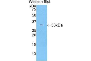 Western Blotting (WB) image for anti-Ceruloplasmin (Ferroxidase) (CP) (AA 789-1065) antibody (ABIN1077926)