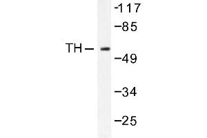 Image no. 1 for anti-Tyrosine Hydroxylase (TH) antibody (ABIN271857) (Tyrosine Hydroxylase antibody)