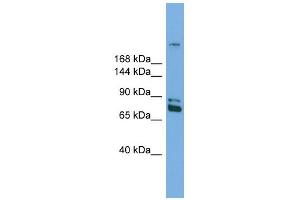 WB Suggested Anti-Dnmt1 Antibody Titration:  0. (DNMT1 antibody  (N-Term))
