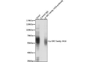 Immunoprecipitation analysis of 200 μg extracts of Jurkat cells, using 3 μg Phospho-SRC Family-Y416 pAb (ABIN6135254, ABIN6136132, ABIN6136133 and ABIN6225536). (Src Family (pTyr416) antibody)