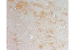Rat brain tissue was stained by anti-AdipoR2 (374-386) (Human) Antiserum (Adiponectin Receptor 2 antibody  (AA 374-386))
