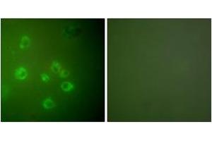 Immunofluorescence analysis of COS7 cells, using GRP78 Antibody. (GRP78 antibody  (AA 605-654))