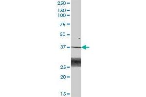 BLVRA MaxPab polyclonal antibody. (Biliverdin Reductase antibody  (AA 1-296))