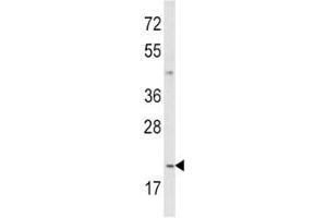 IL12 antibody  (AA 168-195)