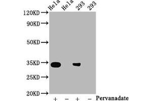 Western Blot Positive WB detected in:Hela whole cell lysate, 293 whole cell lysate(treated with Pervanadate or not) All lanes:Phospho-CDK2 antibody at 0. (Recombinant CDK2 antibody  (pTyr15))