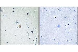 Immunohistochemistry analysis of paraffin-embedded human brain tissue, using Cytochrome P450 2E1 Antibody.
