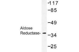 Image no. 1 for anti-Aldo-Keto Reductase Family 1, Member B1 (Aldose Reductase) (AKR1B1) antibody (ABIN317815) (AKR1B1 antibody)