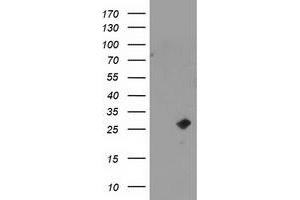 Western Blotting (WB) image for anti-Cyclin-Dependent Kinase Inhibitor 3 (CDKN3) antibody (ABIN1497459) (CDKN3 antibody)