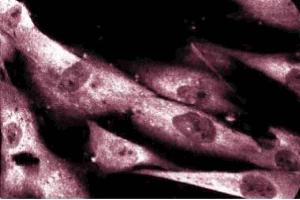 Immunoflouresence staining of human fibroblasts. (DAP Kinase 1 antibody  (AA 694-947))