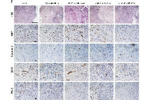 In vivo antitumor effect of miRNA-siRNA combination. (PLK1 antibody  (AA 201-300))