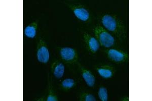 IF analysis of OFD1 using anti-OFD1 antibody (ABIN7602739). (OFD1 antibody  (C-Term))