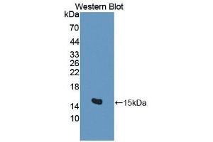 Western blot analysis of the recombinant protein. (BAMBI antibody  (AA 29-130))