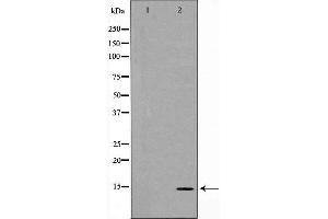 Western blot analysis of Hela cell lysate, using MYL9 Antibody. (MYL9 antibody  (N-Term))