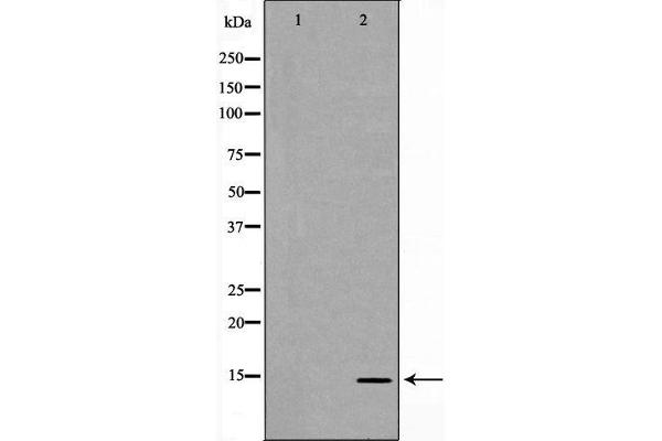 MYL9 antibody  (N-Term)