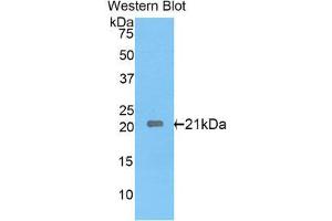 Western Blotting (WB) image for anti-Interleukin 17 Receptor E (IL17RE) (AA 457-626) antibody (ABIN1859366) (IL17RE antibody  (AA 457-626))