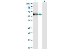 Western Blot analysis of GOLM1 expression in transfected 293T cell line by GOLPH2 monoclonal antibody (M04), clone 3B10. (GOLM1 antibody  (AA 302-401))