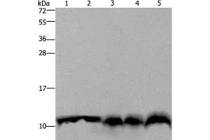 Western Blot analysis of Mouse pancreas tissue, Hela cell and Mouse liver tissue, A549 and 293T cell using UBB Polyclonal Antibody at dilution of 1:500 (Ubiquitin B antibody)