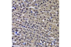 Immunohistochemistry of paraffin-embedded mouse cancer using GPS1 antibody. (GPS1 antibody)