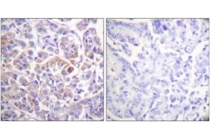 Immunohistochemistry (IHC) image for anti-V-Raf-1 Murine Leukemia Viral Oncogene Homolog 1 (RAF1) (AA 271-320) antibody (ABIN2888728) (RAF1 antibody  (AA 271-320))