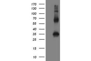 Image no. 2 for anti-Snail Family Zinc Finger 2 (SNAI2) antibody (ABIN1500979) (SLUG antibody)