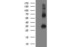 Image no. 2 for anti-Snail Family Zinc Finger 2 (SNAI2) antibody (ABIN1500979)