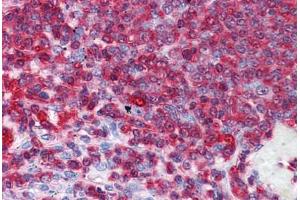 Human Spleen: Formalin-Fixed, Paraffin-Embedded (FFPE) (GDI2 antibody  (AA 1-197))