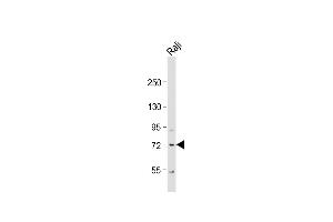 Anti-KLHL6 Antibody (C-term) at 1:1000 dilution + Raji whole cell lysate Lysates/proteins at 20 μg per lane. (KLHL6 antibody  (C-Term))