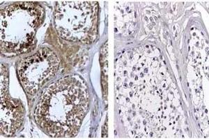 Immunohistochemistry Rabbit Anti-Human DNMT3L Antibody 1:500 (DNMT3L antibody  (AA 152-164))