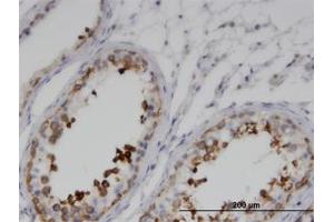 Image no. 1 for anti-G Kinase Anchoring Protein 1 (GKAP1) (AA 1-367) antibody (ABIN599591) (GKAP1 antibody  (AA 1-367))