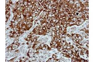 IHC-P Image Immunohistochemical analysis of paraffin-embedded H661 xenograft, using PPP3CB, antibody at 1:500 dilution. (PPP3CB antibody  (Center))