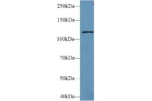 Western Blot; Sample: Mouse Liver lysate; Primary Ab: 2µg/ml Rabbit Anti-Human LARS Antibody Second Ab: 0. (LARS antibody  (AA 260-509))