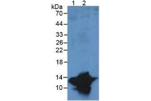 Western Blotting (WB) image for S100 Calcium Binding Protein A9 (S100A9) ELISA Kit (ABIN6730867)