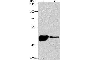 Western blot analysis of 293T and human fetal brain tissue, using MAPK11  Polyclonal Antibody at dilution of 1:200 (MAPK11 antibody)