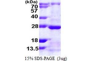 SDS-PAGE (SDS) image for RAB13, Member RAS Oncogene Family (RAB13) (AA 1-200) protein (His tag) (ABIN667931)