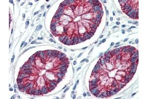 Human Colon (formalin-fixed, paraffin-embedded) stained with CLDN1at 10 µg/ml followed by biotinylated goat anti-rabbit IgG secondary antibody, alkaline phosphatase-streptavidin and chromogen. (Claudin 1 antibody  (C-Term))