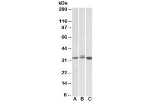 Western blot testing of Daudi (A), Jurkat (B) and K562 (C) lysates with LIVIN antibody at 0. (BIRC7 antibody)